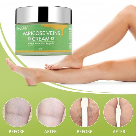 Vein Cream Red Blood Streaks Repair Earthworm Cream